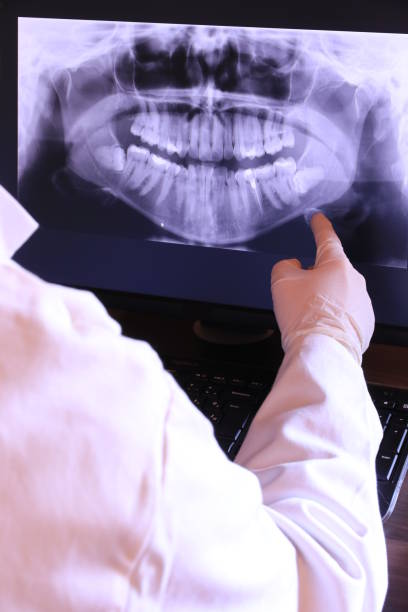 Best Emergency Tooth Extraction in Wesley Chapel, FL